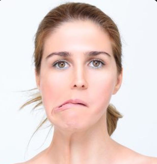 Bell's Palsy